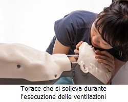 Torace che si solleva durante le ventilazioni Torace che si solleva durante le ventilazioni