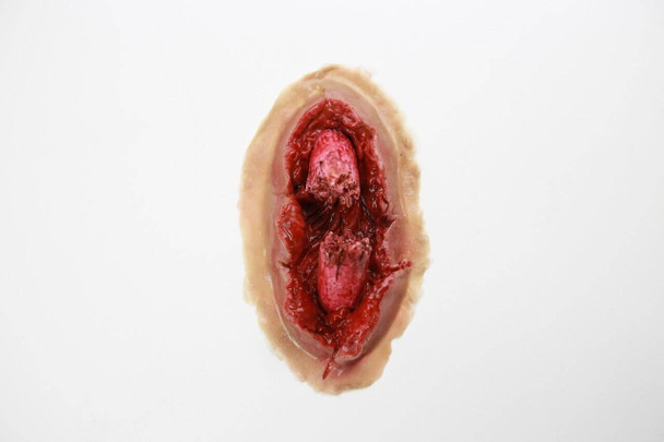 Moulage per simulazione di Frattura Scomposta Emorragica
